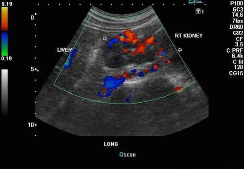 Upper Abdominal And Retroperitoneal Ultrasound K And T Diagnostic Inc 7871