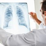 Mobile X-Ray is Revolutionizing Healthcare and Urgent Care