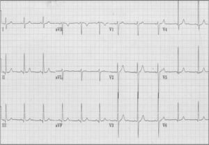 ecg-1-300×208 – K & T Diagnostic, Inc.