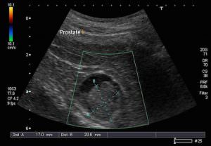 Pelvic Ultrasound | K & T Diagnostic, Inc.